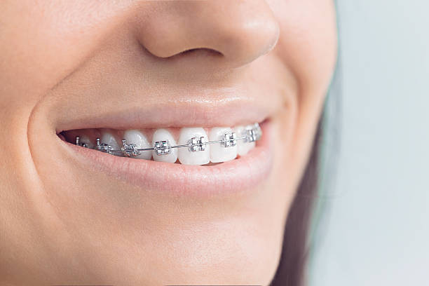 Best Dental Fillings (Composite and Amalgam)  in Robie Creek, ID
